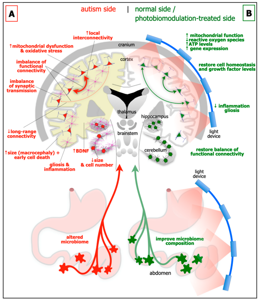 photobiomodulation therapy for autism, brain and nerve health