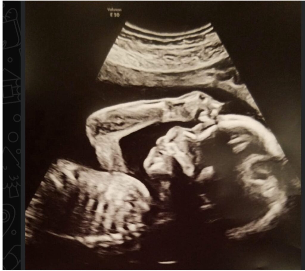 reproductive and endocrine, low level laser therapy, red light for fertility